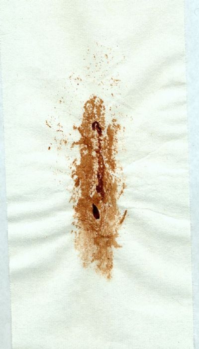 Vulva Print 4